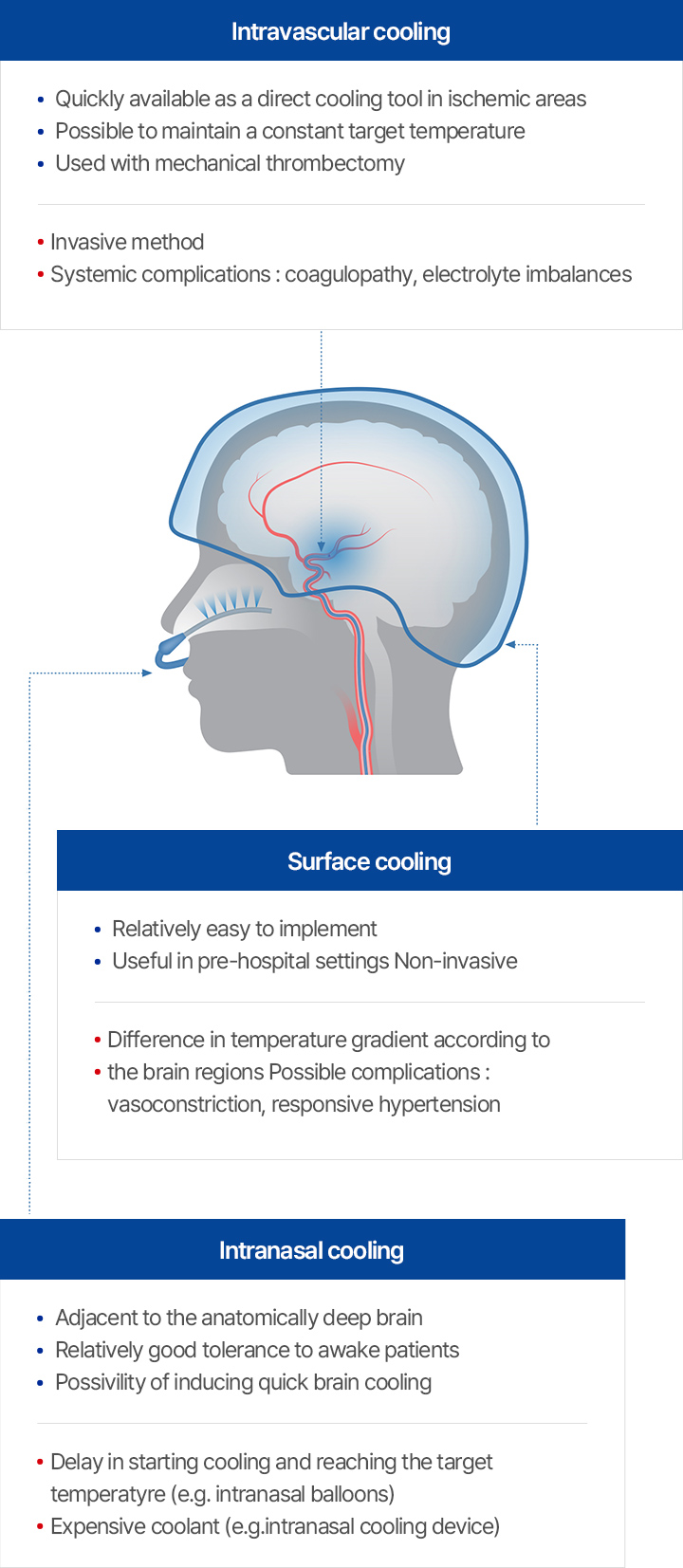 Nasal Selective Brain Cooling Technology image